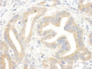 NBP1-71951 - IP3 Receptor 3 / ITPR3