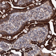 NBP1-92026 - InsP6 kinase 1 / IP6K1