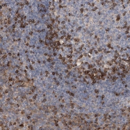 NBP1-83010 - IPCEF1 / PIP3-E