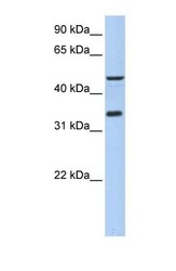NBP1-55367 - IPCEF1 / PIP3-E