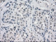 NBP1-47663 - Aurora kinase C