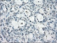 NBP1-47663 - Aurora kinase C