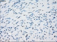 NBP1-47663 - Aurora kinase C
