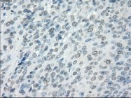 NBP1-47663 - Aurora kinase C