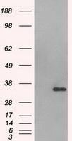 NBP1-47663 - Aurora kinase C