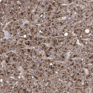 NBP1-90819 - Aurora kinase C