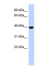 NBP1-54994 - Aurora kinase C