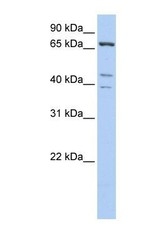 NBP1-56903 - IPP