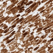 NBP1-83851 - IQCC
