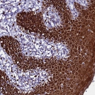 NBP1-92027 - IQCF1
