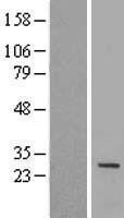NBL1-12021 - IQCF1 Lysate