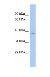 NBP1-56735 - IQCK