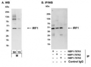 NBP1-78761 - IRF1