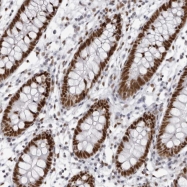 NBP1-93674 - IRF2BP2