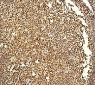 NB100-79983 - IRF3