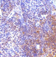 NBP1-77263 - IRF7