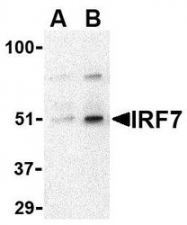 NBP1-77264 - IRF7