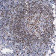 NBP1-81614 - IRF8 / ICSBP1