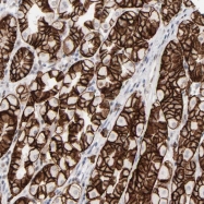 NBP1-81577 - IRF9 / ISGF3G