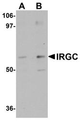 NBP1-77363 - IRGC