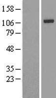 NBL1-12029 - IRP2 Lysate