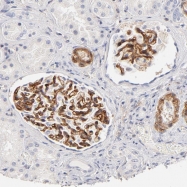 NBP1-86519 - Integrin alpha-8 / ITGA8