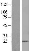 NBL1-12071 - ITGB1BP1 Lysate