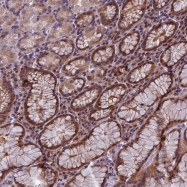 NBP1-84481 - ITGB1BP2 / Melusin