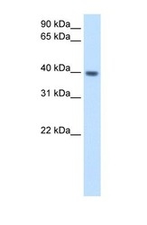 NBP1-55149 - ITGB1BP2 / Melusin