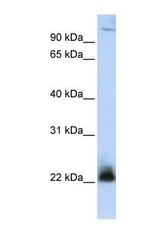 NBP1-59187 - CENP-R / ITGB3BP