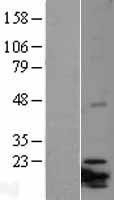NBL1-12074 - ITGB3BP Lysate