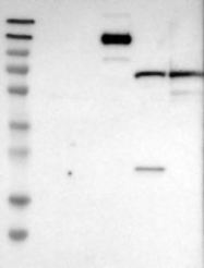 NBP1-93705 - ITIH3