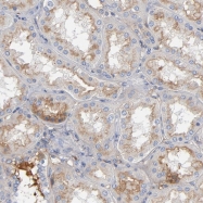 NBP1-81777 - ITIH4