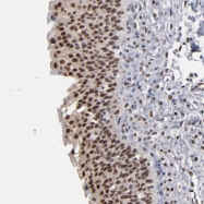 NBP1-88353 - ITM2A