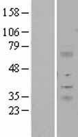 NBL1-12081 - ITM2A Lysate
