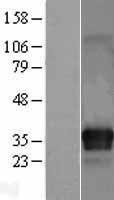 NBL1-12083 - ITM2C Lysate