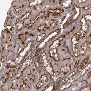 NBP1-81590 - ITPKA / IP3 3-kinase A