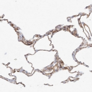 NBP1-81589 - IP3 3-kinase B / ITPKB