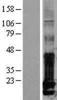 NBL1-11813 - Id1 Lysate