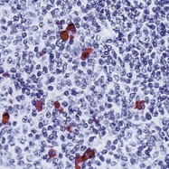 NB120-2411 - Human IgA