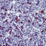 NB120-2410 - Human IgG