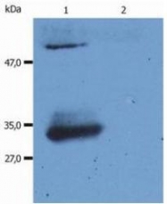 NBP1-44932 - Human IgG