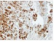 NBP1-31508 - RanBP13 / Importin-13