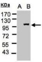 NBP1-31508 - RanBP13 / Importin-13