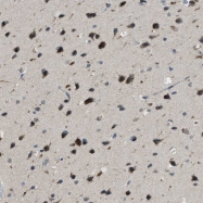 NBP1-87880 - RanBP7 / Importin-7