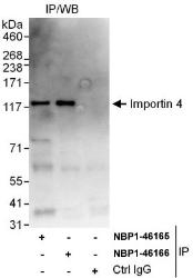 NBP1-46166 - RanBP4 / Importin-4