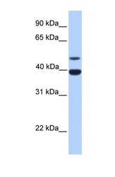 NBP1-58280 - Inhibin alpha / INHA