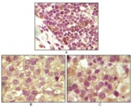 NB110-89459 - Inhibin alpha / INHA