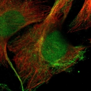 NBP1-89635 - InsP6 kinase 2 / IP6K2