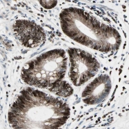 NBP1-89635 - InsP6 kinase 2 / IP6K2